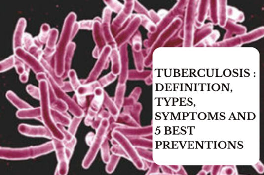 Tuberculosis : Definition, Types, Symptoms and 5 Best Preventions